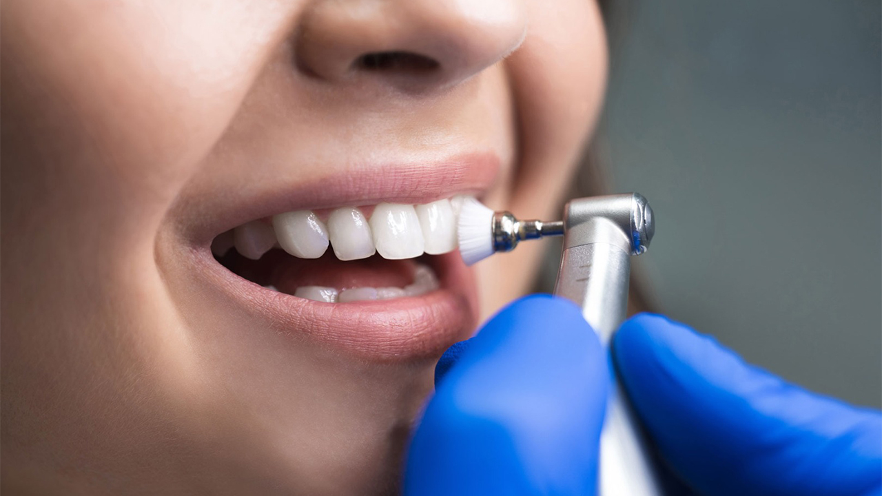 Профессиональная гигиена зубов